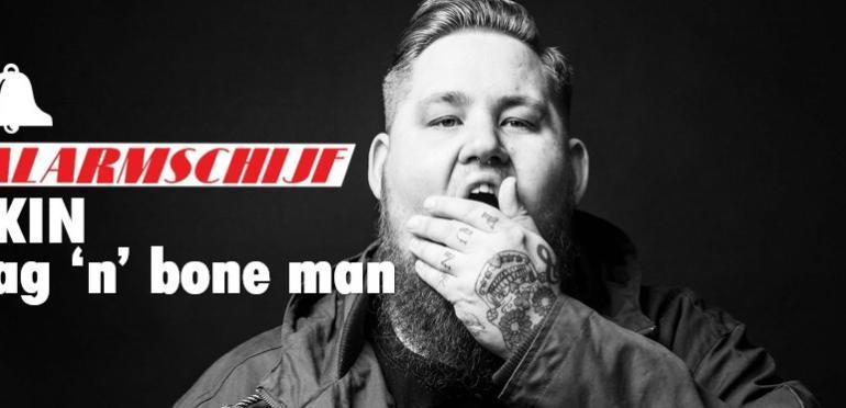 Rag `n` Bone Man scoort Alarmschijf met Skin
